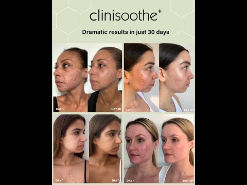 Clinisoothe+ Skin Purifier | Clinisoothe+