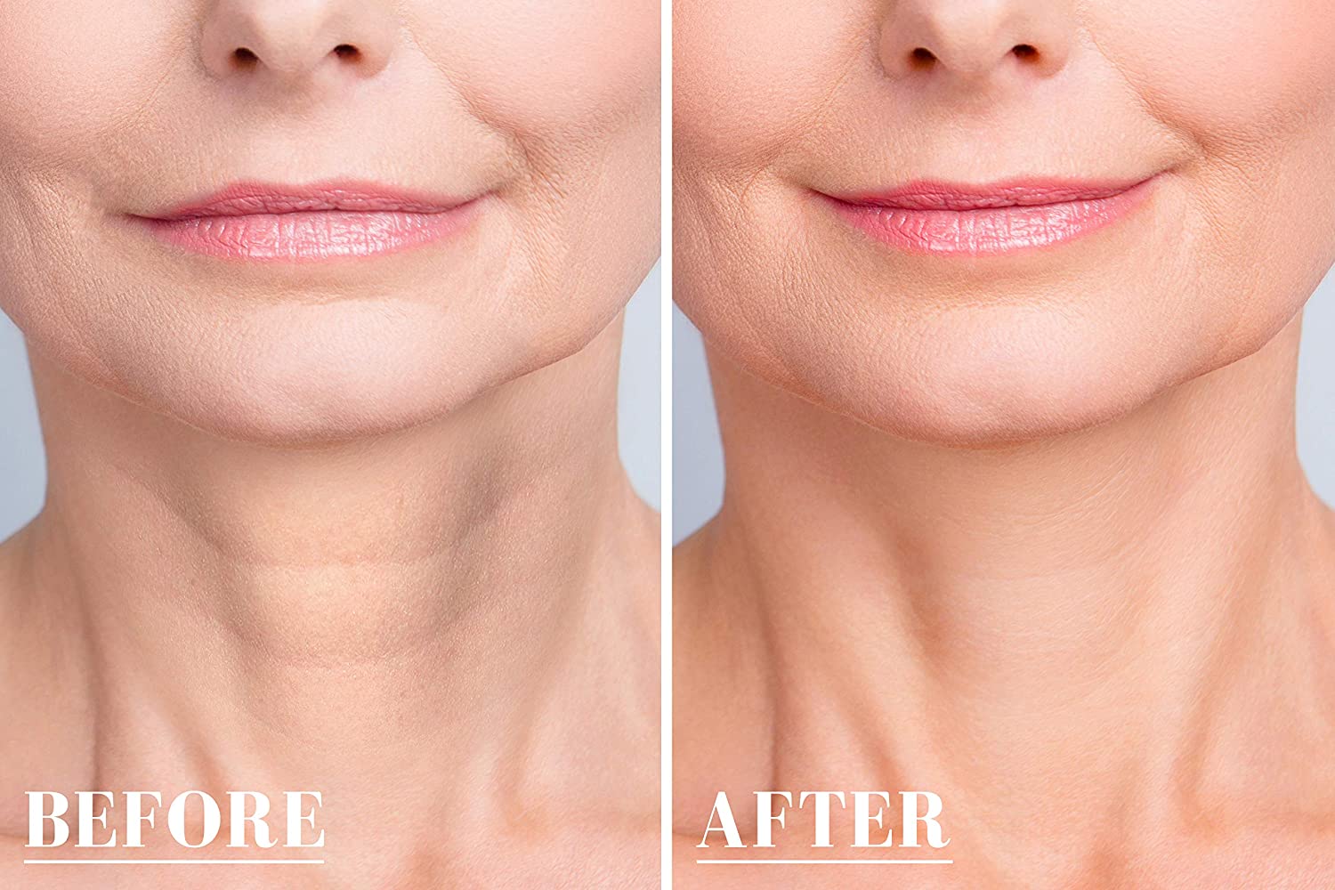 Skin Plumping Neck beauty patch nighttime treatment | Dreambox Beauty