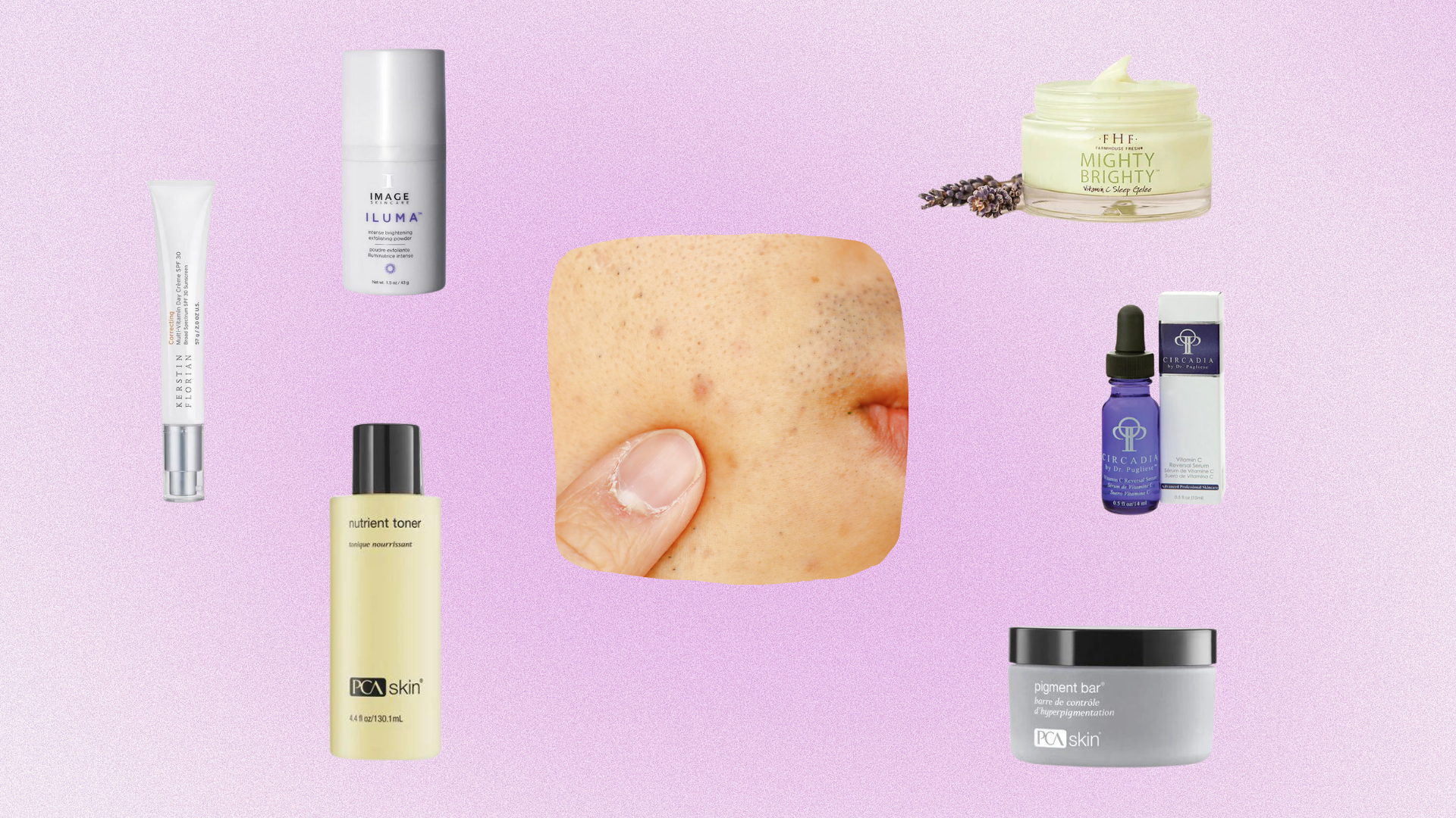 Bye-Bye, Dark Spots: Meet Your Hyperpigmentation Fighting Heroes! 💡