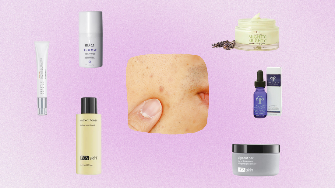 Bye-Bye, Dark Spots: Meet Your Hyperpigmentation Fighting Heroes! 💡