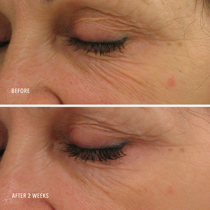 Power Serum | HydroPeptide