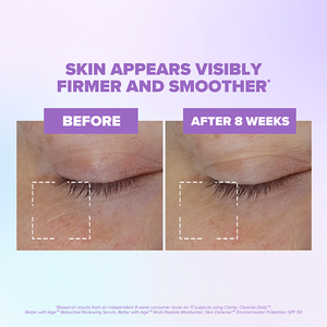 Close-up comparison of skin around the eye before and after 8 weeks showing visibly firmer and smoother skin using Better With Age™ Renewing Bakuchiol Serum | ClarityRX.