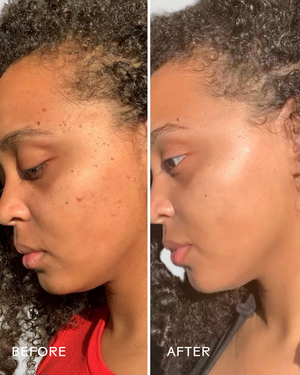 Side-by-side comparison of a woman's face before and after using Superfruit Lactic + Multifruit 8% AHA Exfoliating Mask | Three Ships, showing improved skin clarity and glow.