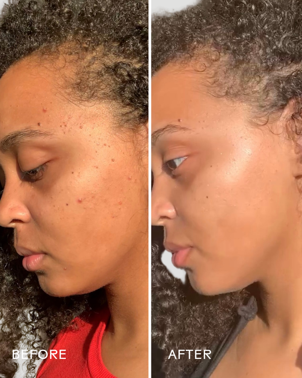 Side-by-side comparison of a woman's face before and after using Superfruit Lactic + Multifruit 8% AHA Exfoliating Mask | Three Ships, showing improved skin clarity and glow.