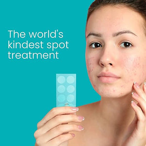 A young woman with acne holds a blister pack of Popspot Spot Treatment - Acne & Pimple Remover Dot (48 Pack) | Popmask against a blue background with the text "The world's kindest spot treatment" promoting gentle skincare.
