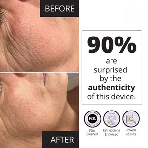Before and after close-up images of facial skin showing visible reduction of wrinkles and fine lines, promoting the Mini Spa Starter Microcurrent Facial Kit | 7e Wellness with FDA cleared, estheticians endorsed, and proven results claims.