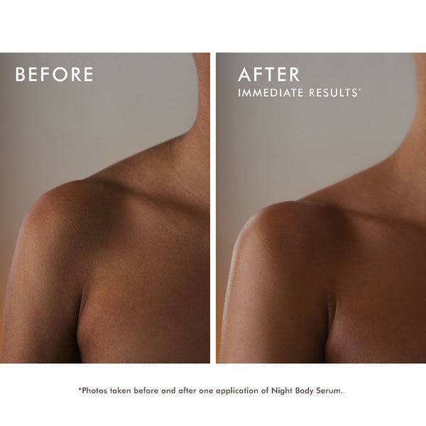 Before and after close-up of a person's shoulder and upper arm showing smoother, more even skin tone after one application of Night Body Serum | Moroccanoil in a skincare comparison image.