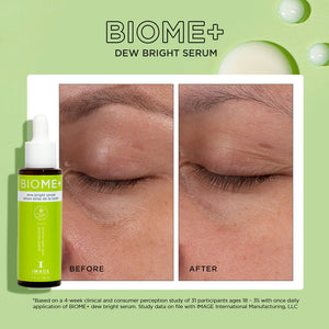 Before and after close-up images of a person's eye area showing improved brightness and reduced dark circles using BIOME+ dew bright serum | IMAGE Skincare, displayed alongside the product bottle.