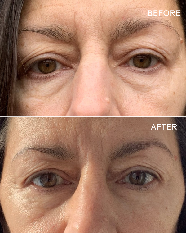 First Light Vitamin C + Caffeine Eye Cream | Three Ships