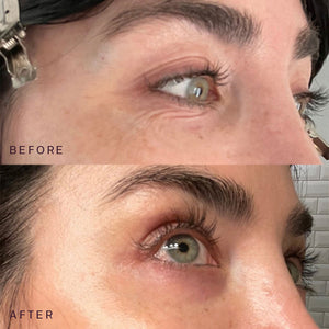 Close-up comparison of a person's eye area showing reduced wrinkles and smoother skin in the after image, demonstrating effects of Ageless Beauty Bundle | Dermaclara skincare.
