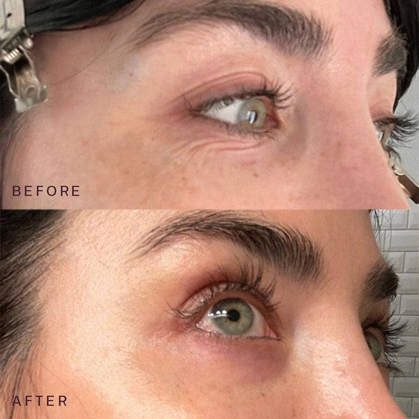 Close-up comparison of a person's eye area showing reduced wrinkles and smoother skin in the after image, demonstrating effects of Ageless Beauty Bundle | Dermaclara skincare.