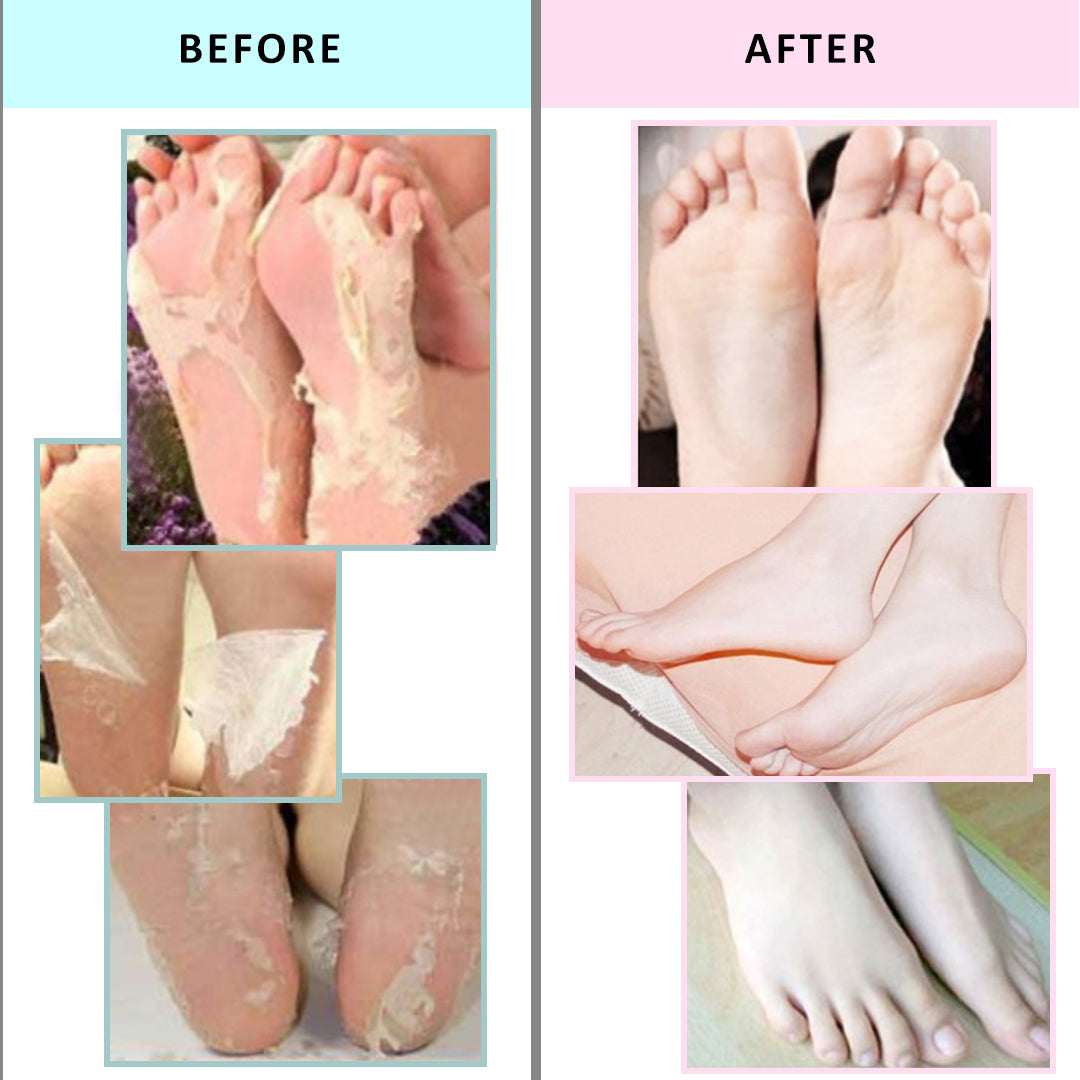 Essential Wonders I Peel Good! Foot Peeling Mask | Leaders