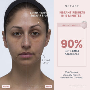 Before and after image showing visible facial lifting effects on the hooded eyelid, brow, and jaw using the MINI+ Starter Kit | NuFACE with claims of instant results in 5 minutes and 90% lifted appearance.