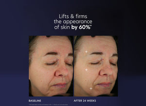 Before and after comparison showing improved skin firmness and lifted appearance on a woman's face after 24 weeks of using ProMax Age Renewal | PCA Skin skincare product.