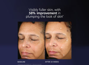 Before and after close-up photos of a woman's face showing visibly fuller skin and a 58 percent improvement in the plumping effect after 24 weeks of using ProMax Age Renewal | PCA Skin, demonstrating skincare results.