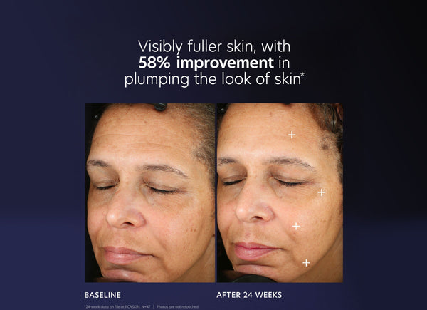 Before and after close-up photos of a woman's face showing visibly fuller skin and a 58 percent improvement in the plumping effect after 24 weeks of using ProMax Age Renewal | PCA Skin, demonstrating skincare results.