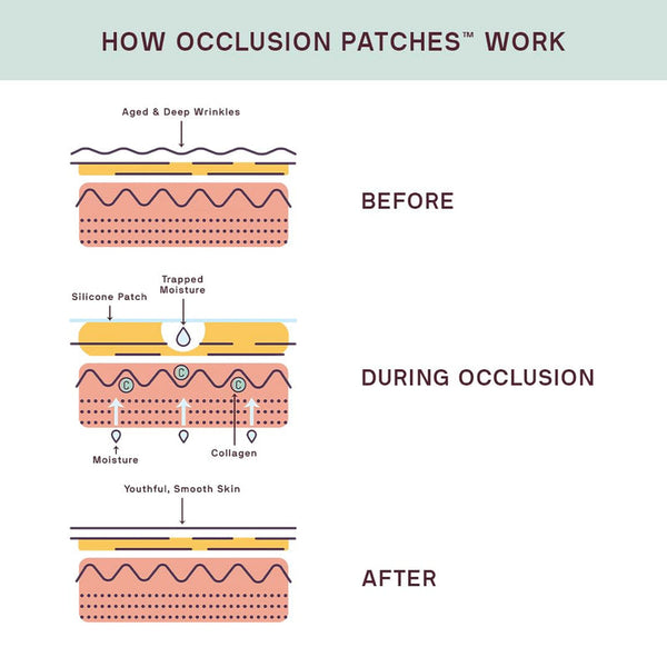 Diagram showing how occlusion patches work to reduce aged and deep wrinkles by trapping moisture and boosting collagen, promoting youthful, smooth skin, for Ageless Beauty Bundle | Dermaclara.
