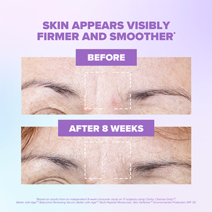 Close-up comparison of a forehead area showing visible improvement in skin firmness and smoothness after 8 weeks of using Better With Age™ Renewing Bakuchiol Serum | ClarityRX, skincare product results.