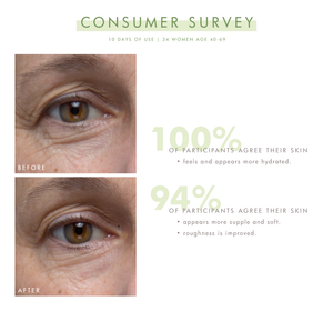 Close-up before and after photos of a woman's eye area showing improved skin hydration, suppleness, and reduced roughness after 10 days of using Lustre Rose™ Serum-in-Oil | Farmhouse Fresh.