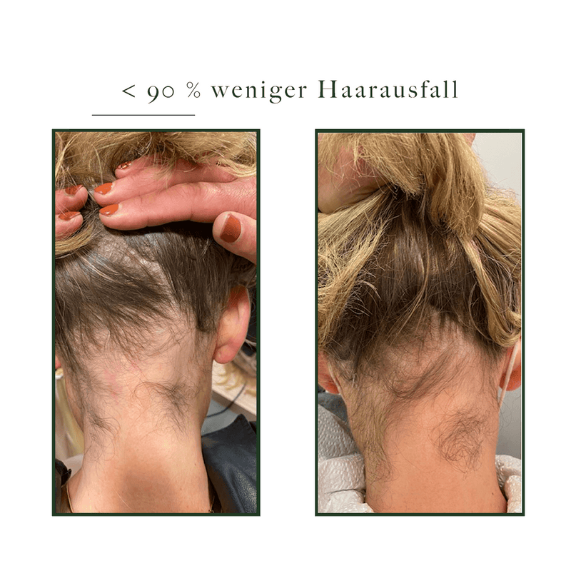 Activator | Hair Natucain