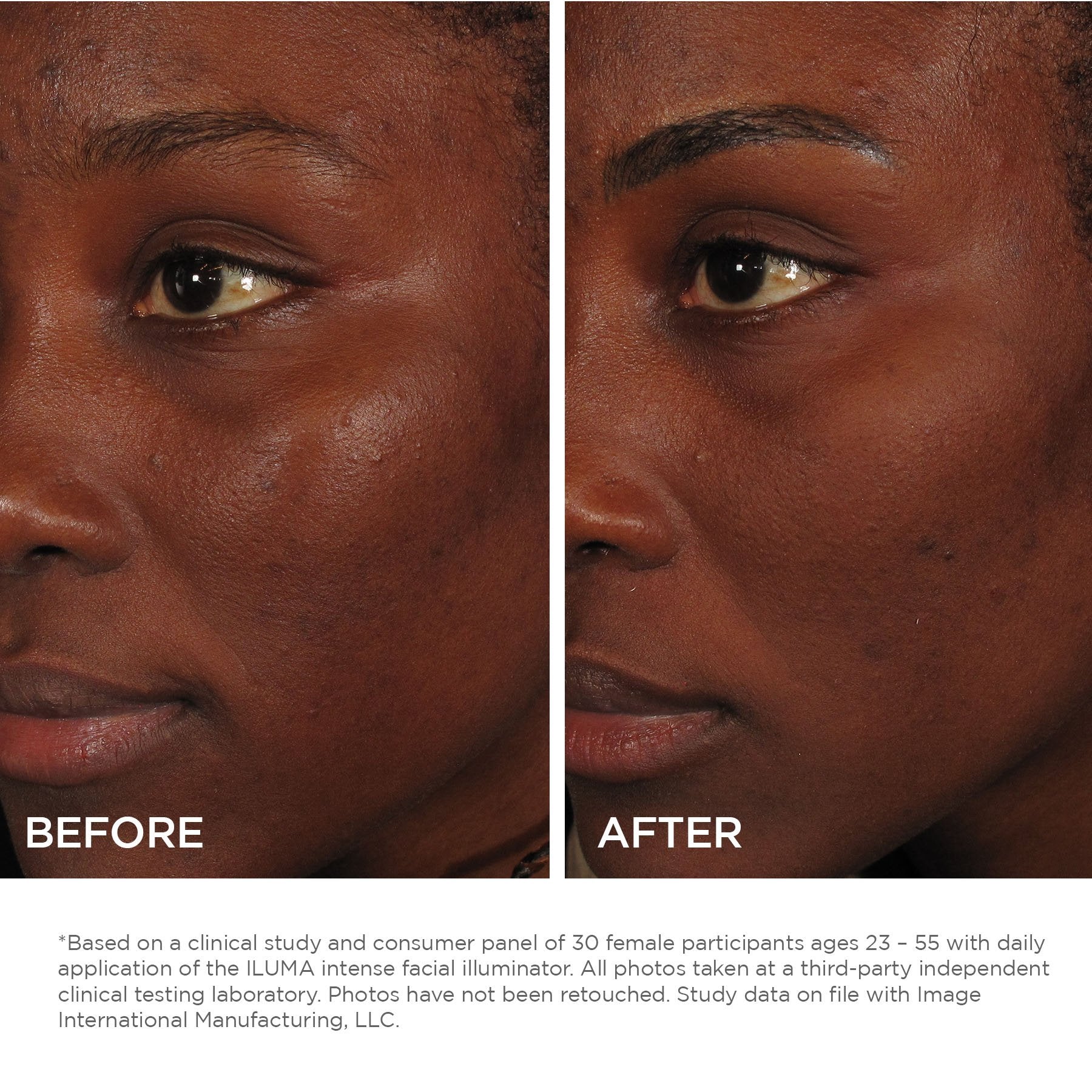 ILUMA intense facial illuminator | IMAGE Skincare