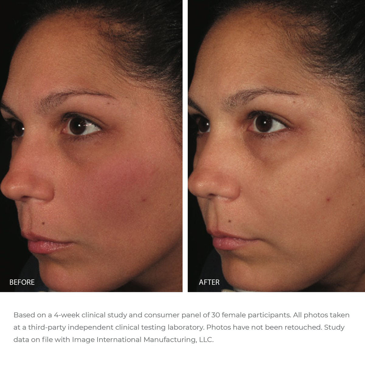 ORMEDIC balancing antioxidant serum | IMAGE Skincare