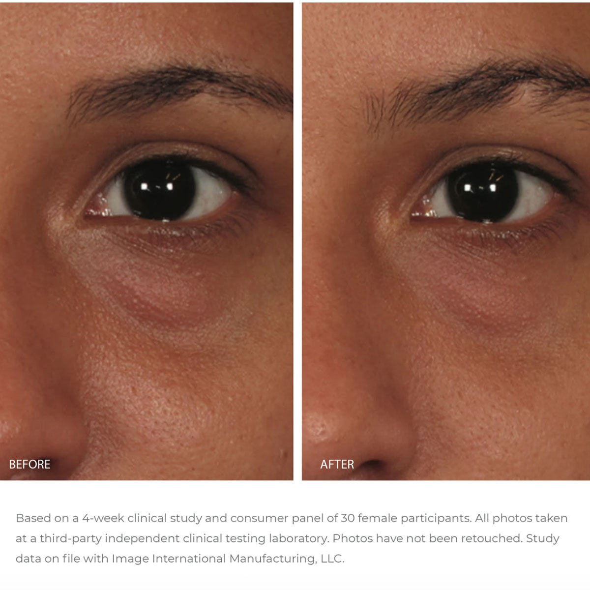 ORMEDIC balancing eye lift gel | IMAGE Skincare