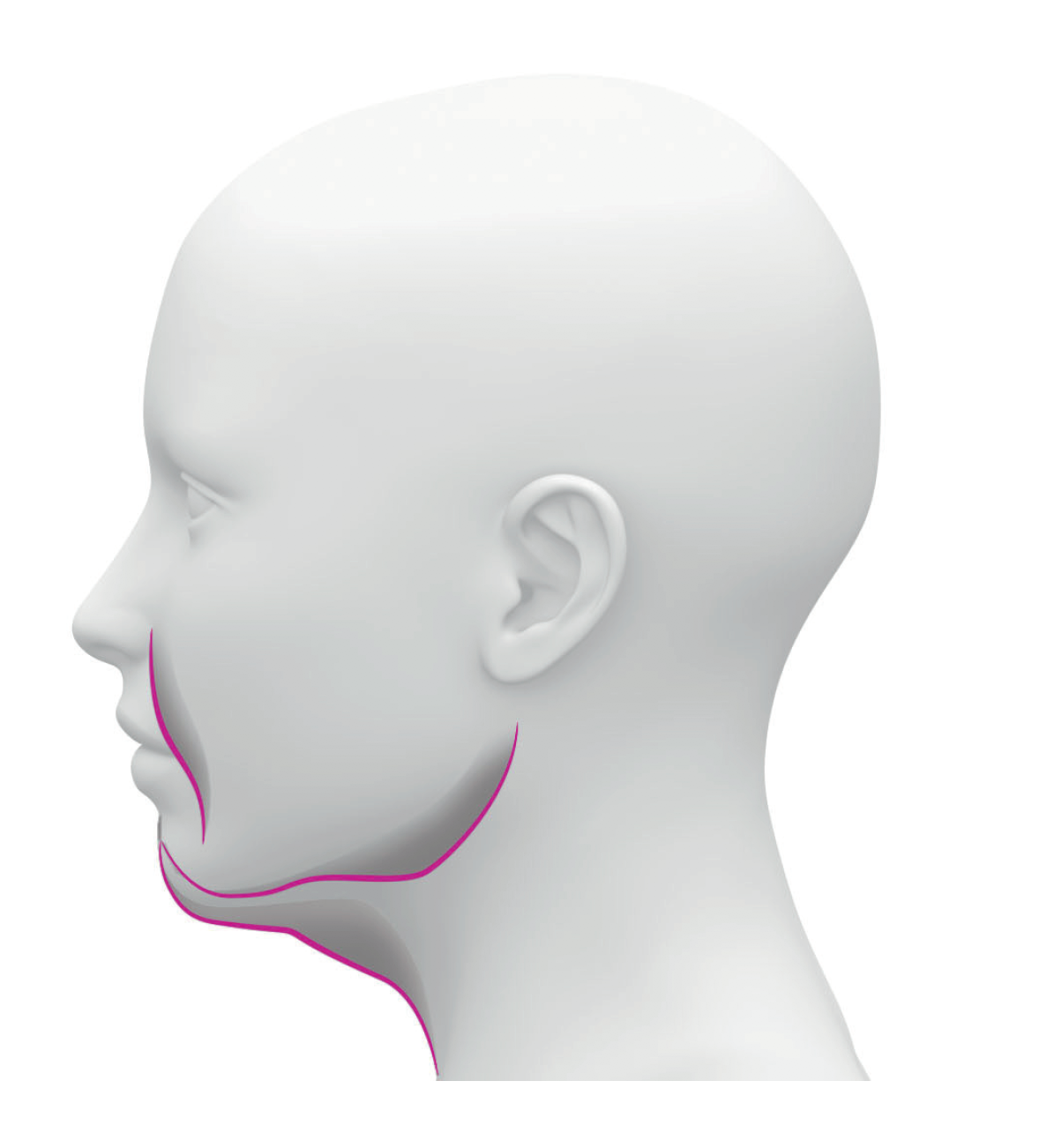 Labo Facial Lifting Treatment Grade 3 - Set | Fillerina