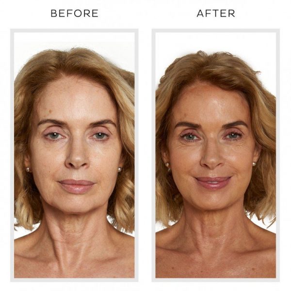 Anti-Aging Serum – LIVISA
